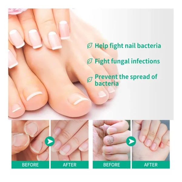 Metanail Complex – Nail & Feet Health Serum - Image 3