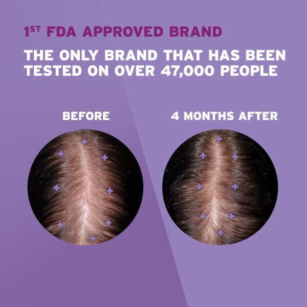 Women’s Rogaine 2% Minoxidil Hair Regrowth Treatment – 1-Month Supply - Image 2